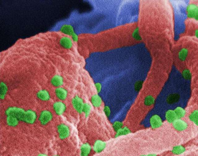Krijohet antitrupi që mund të shërojë virusin HIV