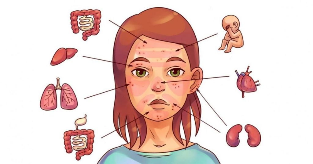 Vëmendje! Këto probleme në lëkurën e fytyrës paralajmërojnë 6 sëmundje brenda trupit tonë