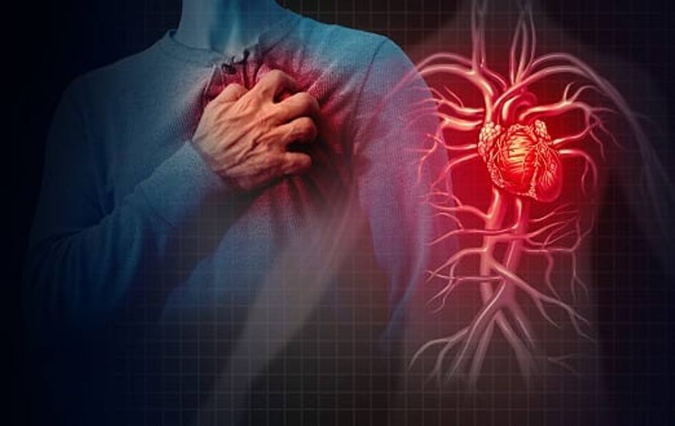 Mpiksja e gjakut në miokardit, COVID-19 mund të dëmtojë rëndë zemrën tuaj