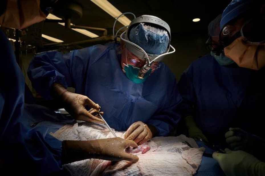 Veshka e një derri transplantohet me sukses tek një grua 66-vjeçare