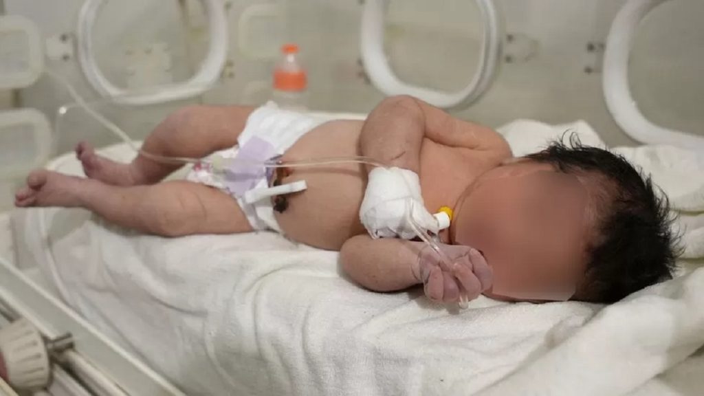 Me kordonin umbelikal të paprerë, foshnja e sapolindur nxirret nga rrënojat në Siri