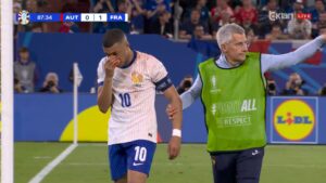 Euro2024| Kylian Mbappe mban ‘peng’ Francën, shmang operacionin pas thyerjes së hundës