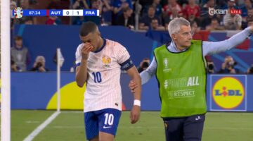 Euro2024| Kylian Mbappe mban ‘peng’ Francën, shmang operacionin pas thyerjes së hundës